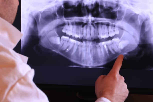 Best Emergency Root Canal Treatment in Robertsville, NJ