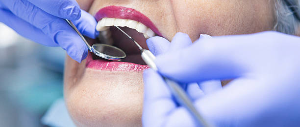 Best Emergency Root Canal Treatment in Robertsville, NJ